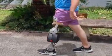 Robotic Leg